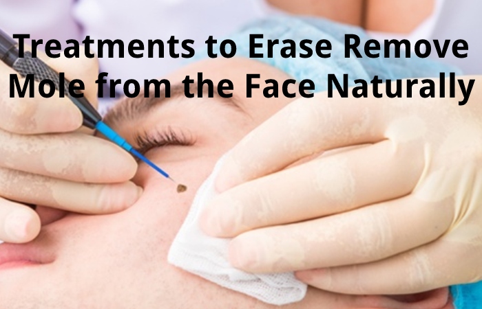 Treatments to Erase Remove Mole from the Face Naturally