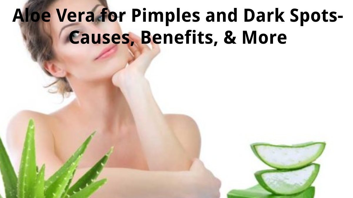 Aloe Vera for Pimples and Dark Spots – Causes, Benefits, & More